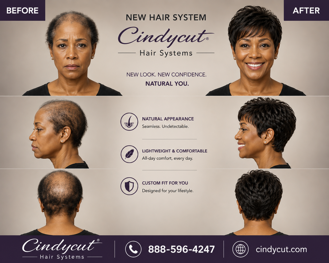 Before & After: A Natural-Looking Hair System Transformation by Cindycut Hair loss can affect more than appearance — it can change the way someone feels walking into a room. This Cindycut before-and-after transformation shows how a custom hair system can restore fullness, shape, and confidence while still looking natural from every angle. Designed for comfort, realism, and a personalized fit, Cindycut Hair Systems are created to blend seamlessly with your lifestyle. From the front view to the side and back, every detail is crafted for a natural appearance, lightweight feel, and everyday confidence. Discover how a custom hair system can give you a fresh look without surgery, without waiting, and without compromise. Ready for your own transformation? Visit Cindycut.com or call 888-596-4247 to schedule your custom consultation.